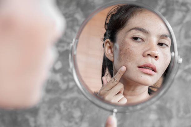 Revitalizing Beauty:7 Remarkable DIY Home Remedies for Skin Dark Spots